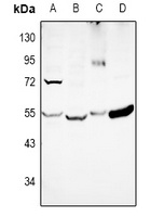 DKK3 antibody