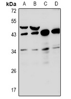 RNF144B antibody