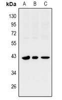 Anti-SIX1 Antibody