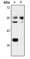 Anti-NARFL Antibody