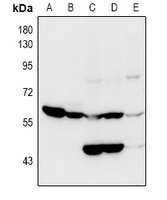 Anti-OCTN2 Antibody