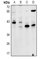 ZDHHC15 antibody