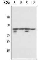 Anti-p46 Antibody