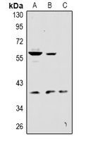 Anti-KCNK12 Antibody