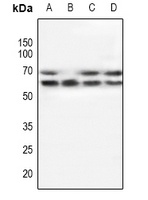 Anti-POTEG Antibody