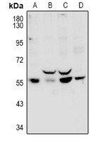 Anti-PPP1R16B Antibody