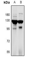 Anti-RANBP17 Antibody