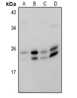 RAB18 antibody