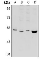 PPP2R2B Rabbit Polyclonal Antibody