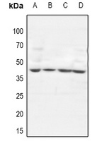 Anti-GTF3A Antibody