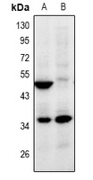 Anti-ZNF771 Antibody