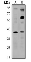 SLC30A8 antibody