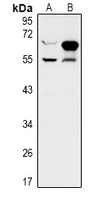 Anti-ZNF446 Antibody