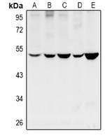 CYP11B1 antibody