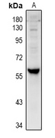 CYP4V2 antibody