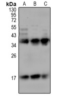 TREM1 antibody