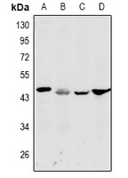 DFFA antibody