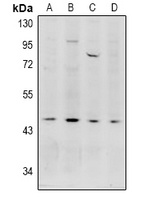 Anti-Acrosin Antibody