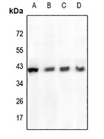 Anti-Cathepsin H Antibody