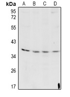 CTSL1 antibody