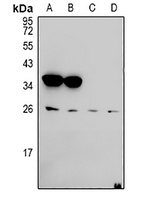 Anti-Ephrin A5 Antibody