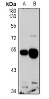 QRFPR antibody