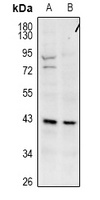 Anti-GPR173 Antibody