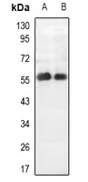 Anti-PALF Antibody