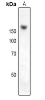Anti-NKTR Antibody