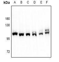 F13A1 antibody