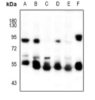 KRT5 antibody