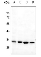 Anti-Mast Cell Tryptase Antibody