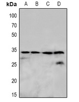 Anti-OTUB1 Antibody