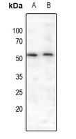 MEF2A (phospho-S408) antibody