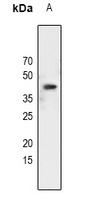 CEBPA (phospho-S21) antibody