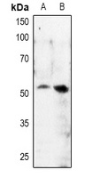 Anti-MITF (Phospho-S180) Antibody