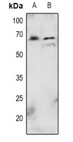 AKT1 (phospho-T72) antibody