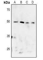 MAPKAPK2 (phospho-T222) antibody