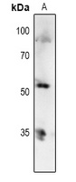 TP53 (phospho-T81) antibody