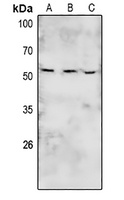 PTK6 (phospho-Y447) antibody