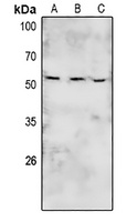 Anti-BRK (Phospho-Y447) Antibody