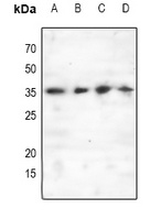 Anti-C/EBP epsilon (Phospho-T74) Antibody