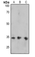 FOSB (phospho-S27) antibody