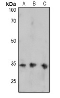 Anti-FOSB (Phospho-S27) Antibody