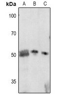 CDKN1C (phospho-T310) antibody