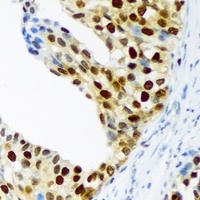 p57 Kip2 (Phospho-T310) Rabbit Polyclonal Antibody
