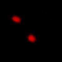 p57 Kip2 (Phospho-T310) Rabbit Polyclonal Antibody