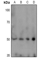 Anti-TPH1 (Phospho-S58) Antibody