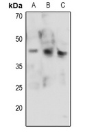 CDK9 (phospho-T186) antibody
