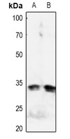 IGFBP3 (phospho-S183) antibody